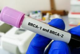 BRCA1 BRCA2